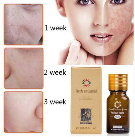 Image of Pure Natural Essential Ultra Brightening Spotless Oil Dark Spots Fade Away Age Spots Hyper Pigmentation Essential Oil.