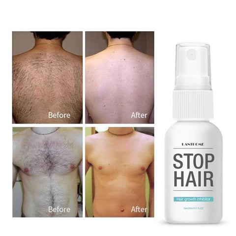 Image of Stop Hair Serum